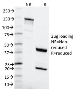 SDS-PAGE Analysis Purified MSH6 Mouse Monoclonal Antibody (MSH6/2111). Confirmation of Purity and Integrity.