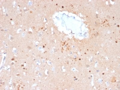 Formalin-fixed paraffin-embedded human Brain stained with Ubiquitin Mouse Monoclonal Antibody (UBB/2122).