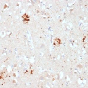 Formalin-fixed paraffin-embedded human Brain stained with Ubiquitin Mouse Monoclonal Antibody (UBB/2122).