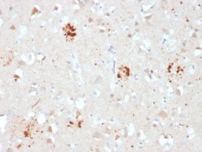 Formalin-fixed paraffin-embedded human Brain stained with Ubiquitin Mouse Monoclonal Antibody (UBB/2122).
