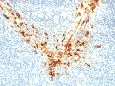Formalin-fixed paraffin-embedded human Tonsil stained with Mesothelin Mouse Monoclonal Antibody (MSLN/2131).