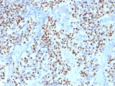Formalin-fixed paraffin-embedded human Lymph Node stained with Oct-2 Mouse Monoclonal Antibody (OCT2/2136).