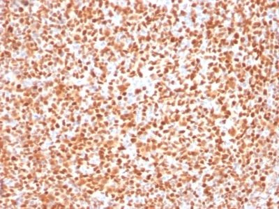 Formalin-fixed paraffin-embedded human Tonsil stained with Oct-2 Mouse Monoclonal Antibody (OCT2/2137).