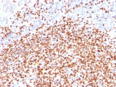 Formalin-fixed paraffin-embedded human Lymph Node stained with Oct-2 Mouse Monoclonal Antibody (OCT2/2137).