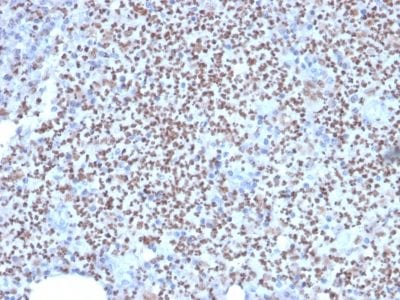 Formalin-fixed paraffin-embedded human Lymph Node stained with PU.1 Mouse Monoclonal Antibody (PU1/2146).