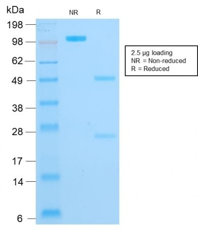 SDS-PAGE Analysis Purified CK16 Mouse Recombinant Monoclonal Antibody (rKRT16/1714). Confirmation of Purity and Integrity of Antibody.