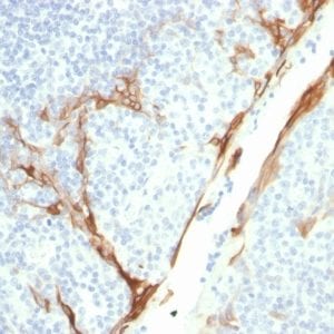 Formalin-fixed paraffin-embedded human Tonsil stained with CK16 Mouse Recombinant Monoclonal Antibody (rKRT16/1714).
