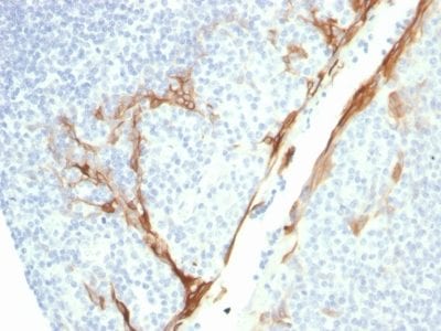 Formalin-fixed paraffin-embedded human Tonsil stained with CK16 Mouse Recombinant Monoclonal Antibody (rKRT16/1714).
