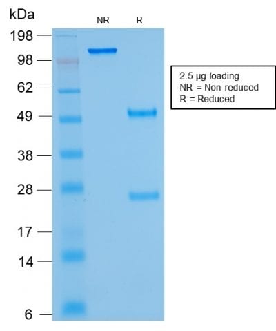 SDS-PAGE Analysis Kappa Light Chain Mouse Recombinant Monoclonal Antibody (rKLC264). Confirmation of Purity and Integrity of Antibody.