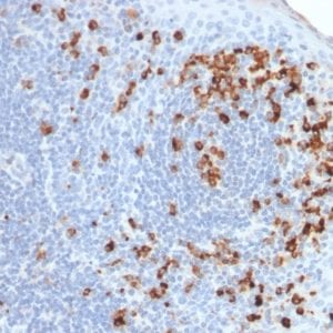 Formalin-fixed paraffin-embedded human Tonsil stained with Kappa Light Chain Mouse Recombinant Monoclonal Antibody (rKLC264).