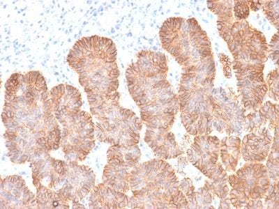 Formalin-fixed paraffin-embedded Human Skin tissue stained with EpCAM Mouse Recombinant Monoclonal Antibody (rEGP40/1372).