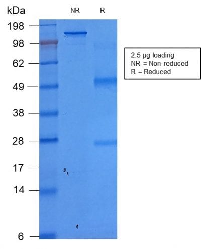 SDS-PAGE Analysis Purified EpCAM Mouse Recombinant Monoclonal Antibody (rEGP40/1372). Confirmation of Purity and Integrity of Antibody.