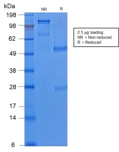 SDS-PAGE Analysis of Purified Cytokeratin 8 Rabbit Recombinant Monoclonal Antibody (KRT8/2174R). Confirmation of Purity and Integrity of Antibody.