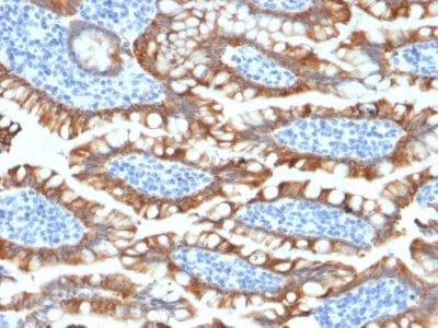Formalin-paraffin human Small Intestine stained with Cytokeratin 8 Rabbit Recombinant Monoclonal Antibody (KRT8/2174R).