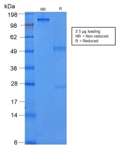 SDS-PAGE Analysis Purified Cytokeratin 8 Mouse Recombinant Monoclonal Antibody (rB22.1). Confirmation of Purity and Integrity of Antibody.