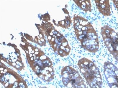 Formalin-fixed paraffin-embedded human Colon stained with Cytokeratin 8 Mouse Recombinant Monoclonal Antibody (rB22.1).