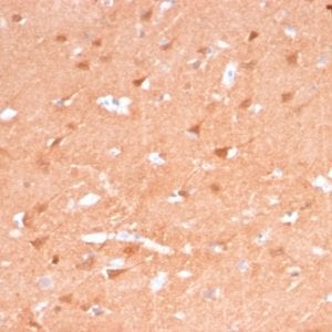 Formalin-fixed paraffin-embedded Human Brain stained with Pgp9.5 Mouse Recombinant Monoclonal Antibody (rUCHL1/775).