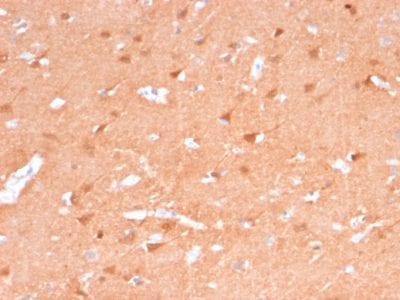 Formalin-fixed paraffin-embedded Human Brain stained with Pgp9.5 Mouse Recombinant Monoclonal Antibody (rUCHL1/775).