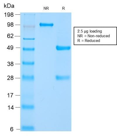 SDS-PAGE Analysis of Purified HSP60 Rabbit Recombinant Monoclonal Antibody (HSPD1/2206R). Confirmation of Purity and Integrity of Antibody.