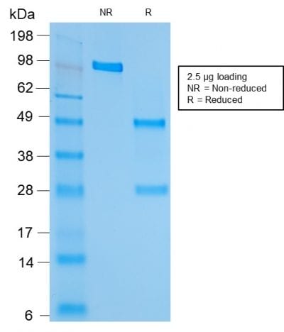 SDS-PAGE Analysis Purified HSP60 Mouse Recombinant Monoclonal Antibody (rGROEL/780). Confirmation of Purity and Integrity of Antibody.