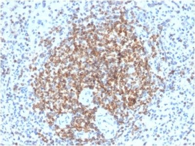 Formalin-fixed paraffin-embedded human spleen stained with Bcl-2 Rabbit Recombinant Monoclonal Antibody (BCL2/2210R).