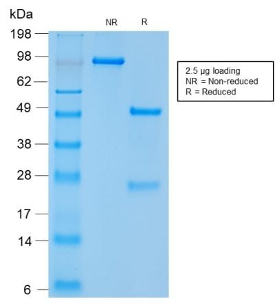 SDS-PAGE Analysis Purified CD56 Rabbit Recombinant Monoclonal Antibody (NCAM1/2217R). Confirmation of Purity and Integrity of Antibody.