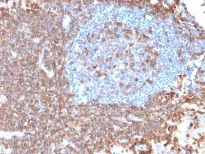 Formalin-fixed paraffin-embedded human Lymph Node stained with CD43 Mouse Recombinant Monoclonal Antibody (rSPN/839).