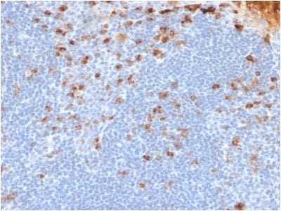 Formalin-fixed paraffin-embedded human Tonsil stained with Kappa Light Chain Mouse Recombinant Monoclonal Antibody (rL1C1).