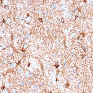 Formalin-fixed paraffin-embedded human Cerebellum stained with GFAP Mouse Recombinant Monoclonal Antibody (rASTRO/789).
