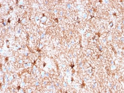 Formalin-fixed paraffin-embedded human Cerebellum stained with GFAP Mouse Recombinant Monoclonal Antibody (rASTRO/789).