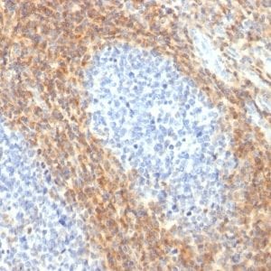 Formalin-fixed paraffin-embedded Human Tonsil stained with CD52 Rabbit Recombinant Monoclonal Antibody (CD52/2276R).