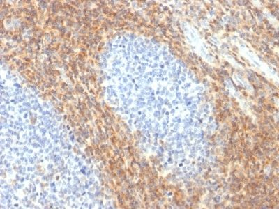 Formalin-fixed paraffin-embedded Human Tonsil stained with CD52 Rabbit Recombinant Monoclonal Antibody (CD52/2276R).