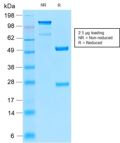 SDS-PAGE Analysis of Purified Insulin Receptor Rabbit Recombinant Monoclonal Antibody (INSR/2277R). Confirmation of Purity and Integrity of Antibody.