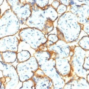 Formalin-fixed paraffin-embedded human Placenta stained with Insulin Receptor Rabbit Recombinant Monoclonal Antibody (INSR/2277R).