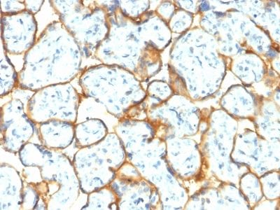 Formalin-fixed paraffin-embedded human Placenta stained with Insulin Receptor Rabbit Recombinant Monoclonal Antibody (INSR/2277R).