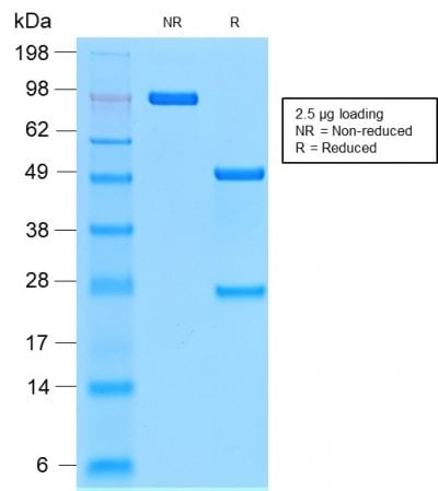 SDS-PAGE Analysis Purified MUC1 Rabbit Recombinant Monoclonal Antibody (MUC1/2278R). Confirmation of Purity and Integrity of Antibody.