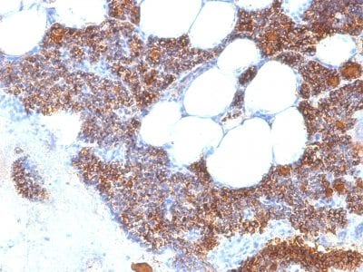 Formalin-fixed paraffin-embedded human Parathyroid stained with PTH Rabbit Recombinant Monoclonal Antibody (PTH/2295R).