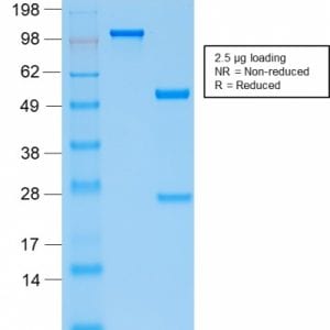 SDS-PAGE Analysis Purified PTH Rabbit Recombinant Monoclonal Antibody (PTH/2295R). Confirmation of Purity and Integrity of the Antibody.