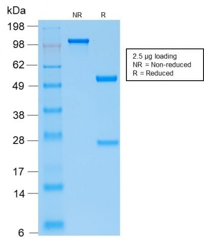 SDS-PAGE Analysis Purified PTH Rabbit Recombinant Monoclonal Antibody (PTH/2295R). Confirmation of Purity and Integrity of the Antibody.