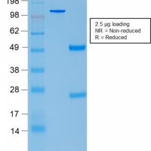 SDS-PAGE Analysis Purified ACTH Mouse Recombinant Monoclonal Antibody (rCLIP/1407). Confirmation of Purity and Integrity of Antibody.