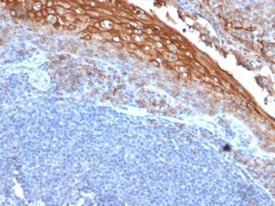 Formalin-fixed paraffin-embedded human Tonsil stained with MUC18 Mouse Recombinant Monoclonal Antibody (rMUC18/1130).