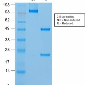 SDS-PAGE Analysis of Purified MUC18 Mouse Recombinant Monoclonal Antibody (rMUC18/1130). Confirmation of Purity and Integrity of Antibody.