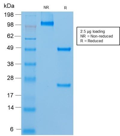 SDS-PAGE Analysis of Purified MUC18 Mouse Recombinant Monoclonal Antibody (rMUC18/1130). Confirmation of Purity and Integrity of Antibody.