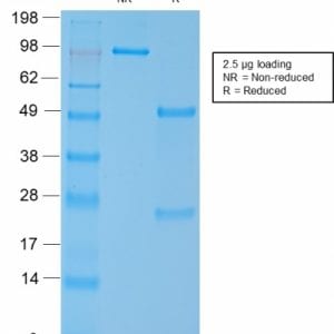 SDS-PAGE Analysis Purified SM-MHC Recombinant Rabbit Monoclonal Antibody (MYH11/2303R). Confirmation of Purity and Integrity of the Antibody.