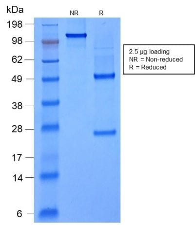 SDS-PAGE Analysis Purified FOXA1 Mouse Recombinant Monoclonal Antibody (rFOXA1/1515). Confirmation of Purity and Integrity of Antibody.