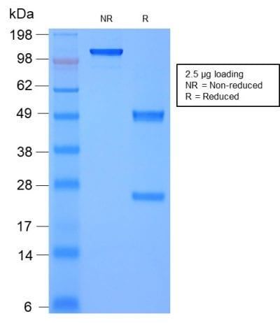 SDS-PAGE Analysis Purified Moesin Mouse Recombinant Monoclonal Antibody (rMSN/492). Confirmation of Purity and Integrity of Antibody.