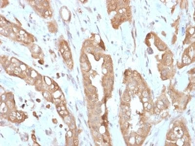 Formalin-fixed paraffin-embedded human Small Intestine stained with Villin Rabbit Recombinant Monoclonal Antibody (VIL1/2310R).