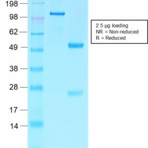 SDS-PAGE Analysis Purified Villin Rabbit Recombinant Monoclonal Antibody (VIL1/2310R). Confirmation of Purity and Integrity of the Antibody.