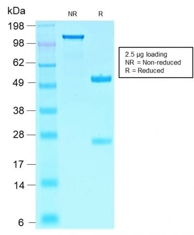 SDS-PAGE Analysis PurifiedSOX10 Rabbit Recombinant Monoclonal Antibody(SOX10/2311R). Confirmation of Purity and Integrity of Antibody.