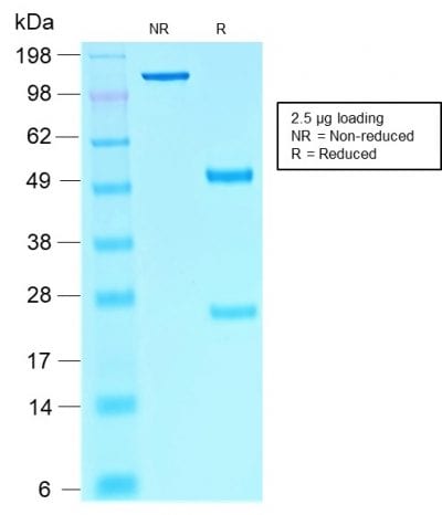 SDS-PAGE Analysis Purified SOX10 Mouse Recombinant Monoclonal Antibody (rSOX10/1074). Confirmation of Purity and Integrity of Antibody.